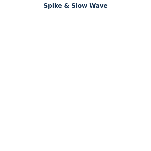Generated EEG — Spike & Slow Wave
