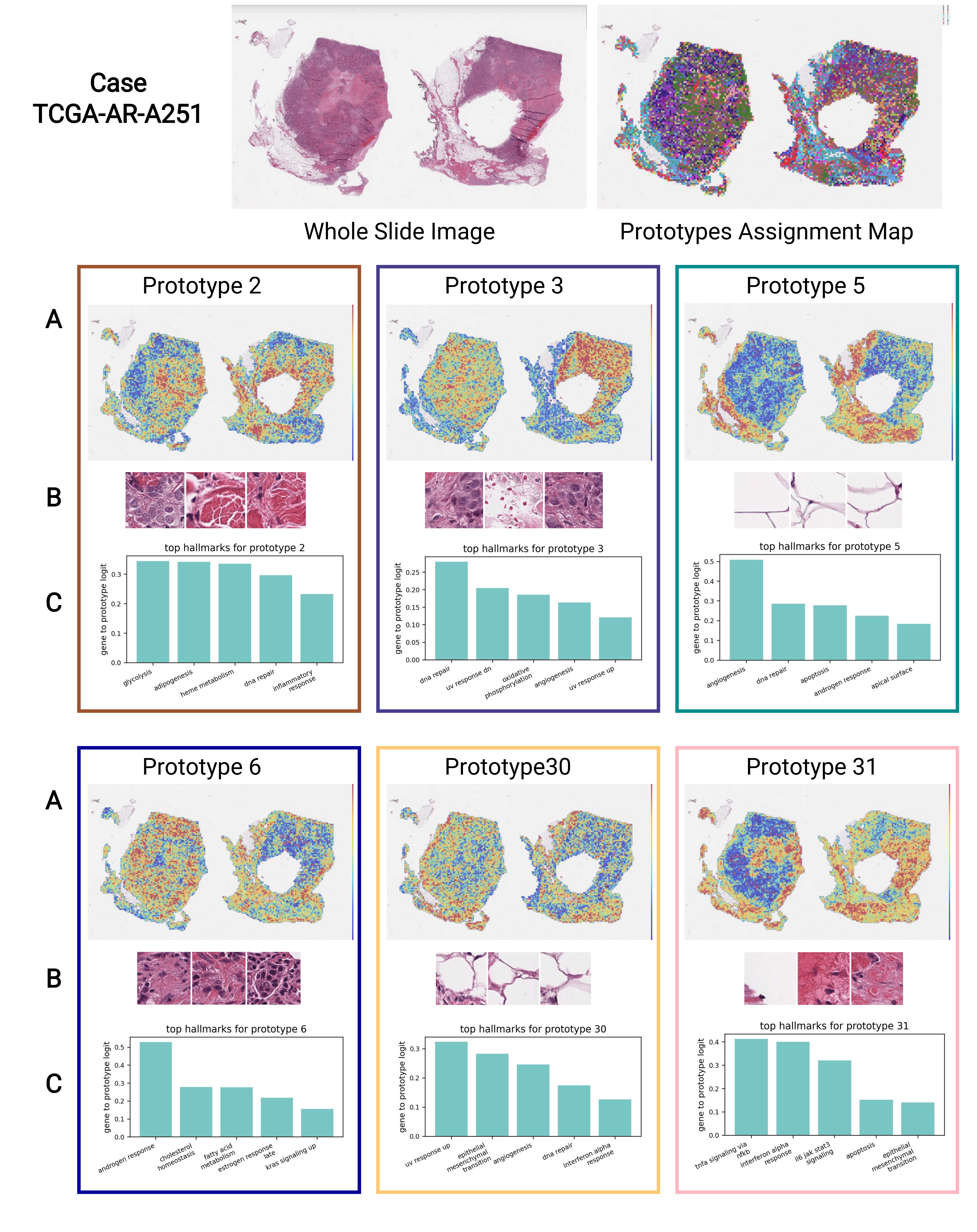 Prototype-centered visualization for TCGA-AR-A251